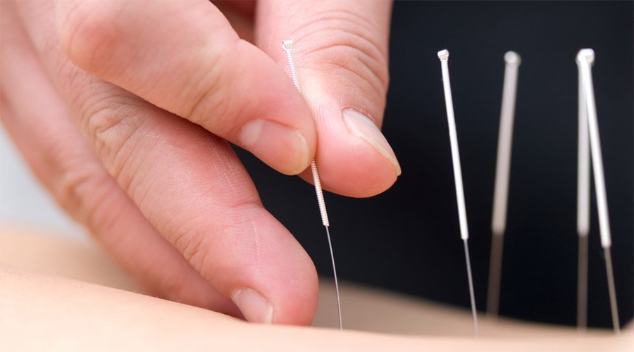 Massage chinois et acupuncture